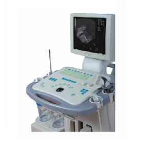 Machine de système de diagnostic à ultrasons visible Gyn approuvée CE/ISO (MT01006081)
